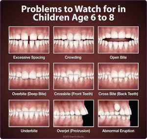 Problems to look out for in childrens teeth