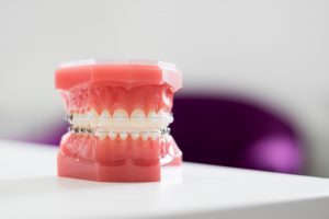 Tamworth-Dental-orthodontics-clinic