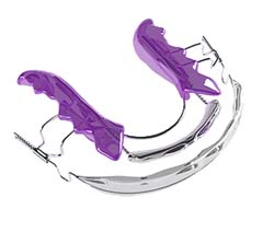 What are inman aligners