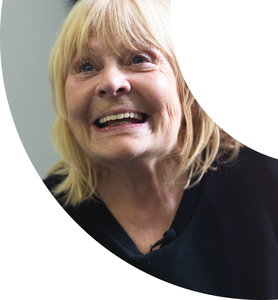 sutton coldfield dental implants